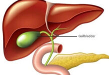 Gallbladder removal: what happens next and 3 risks to watch for