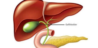 Gallbladder removal: what happens next and 3 risks to watch for