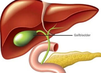 Gallbladder removal: what happens next and 3 risks to watch for