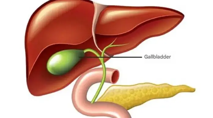Gallbladder removal: what happens next and 3 risks to watch for