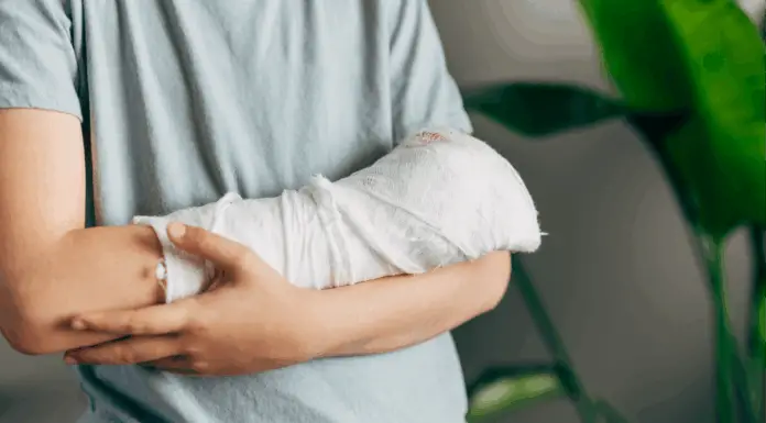 Bizarre theories about people who have ‘never broken a bone’