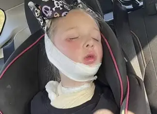 Parents warn of fatal microwave mistake after 7-year-old girl suffers severe injuries and falls into a coma