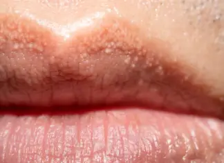 Reason behind strange white bumps found on your private parts