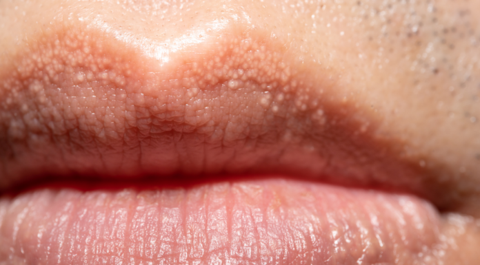 Reason behind strange white bumps found on your private parts