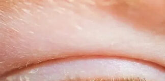 The science behind eye ‘sleep:’ What that crust really is