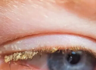 The science behind eye ‘sleep:’ What that crust really is