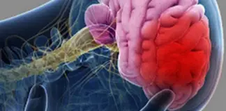 4 common morning habits that may increase your risk of stroke