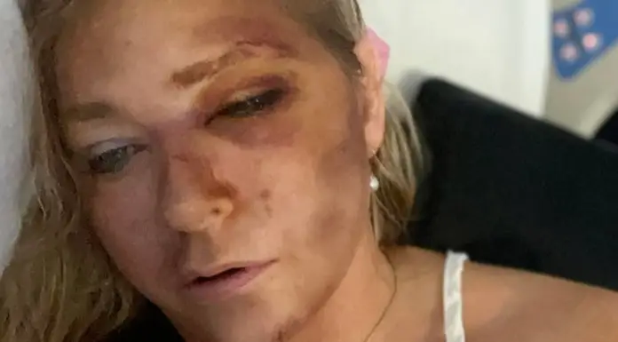 Jeffrey Epstein accuser Virginia Giuffre announces she only has ‘days left to live’ in heartbreaking social media post