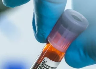 Doctors identify the blood type most at risk for developing stomach cancer