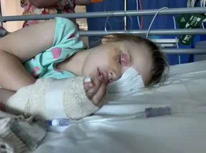 The girl was helping her mom with the laundry when she bit into the washing pod that burst into her face, leaving her temporarily blinded.