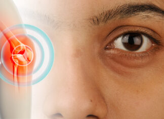 Dark eye circles might be a subtle health warning