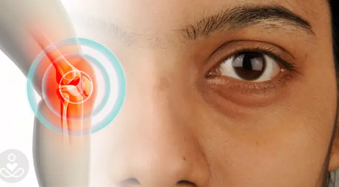 Dark eye circles might be a subtle health warning