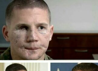 I hid my face for years – until the day I received the medal