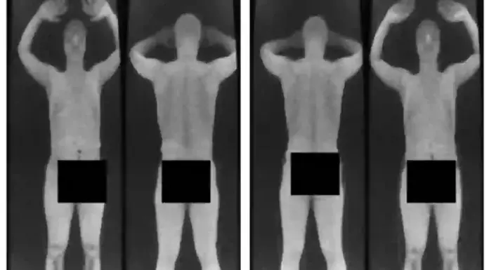 Shocking truth about what airport X-ray scanners actually reveal
