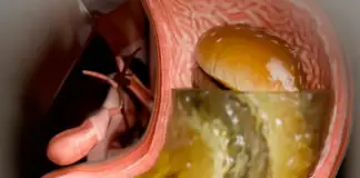 Simulation reveals harsh effects of Ozempic on the body