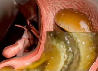 Simulation reveals harsh effects of Ozempic on the body