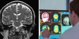 Neurologist reveals the scariest thing people do to their brains