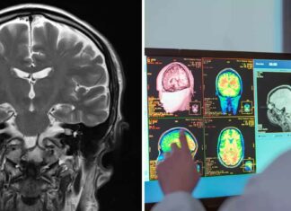 Neurologist reveals the scariest thing people do to their brains