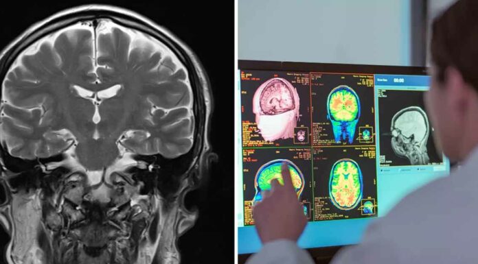 Neurologist reveals the scariest thing people do to their brains