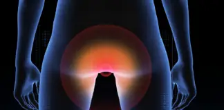 Study suggests anal cancer is on the rise and reveals who’s most at risk