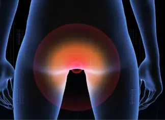 Study suggests anal cancer is on the rise and reveals who’s most at risk