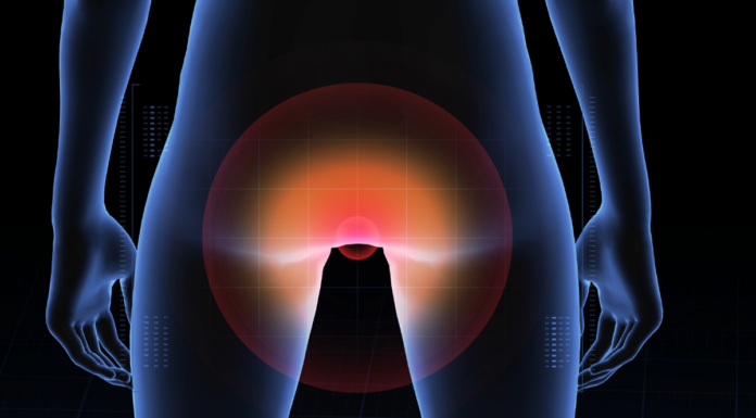 Study suggests anal cancer is on the rise and reveals who’s most at risk