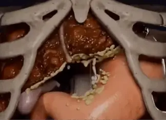 Dangers of 36-hour fasting revealed in shocking simulation