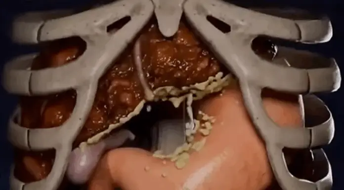 Dangers of 36-hour fasting revealed in shocking simulation