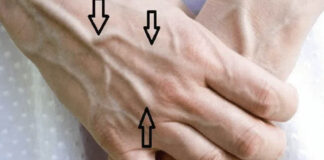 Why are your veins suddenly bulging and visible?