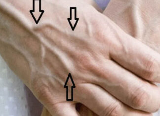 Why are your veins suddenly bulging and visible?