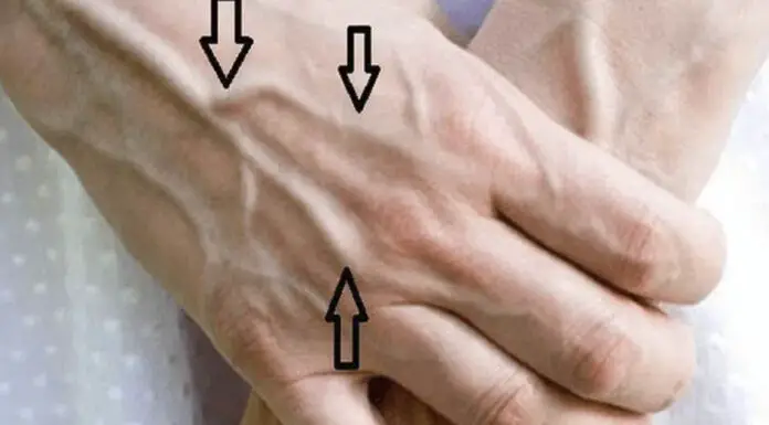 Why are your veins suddenly bulging and visible?