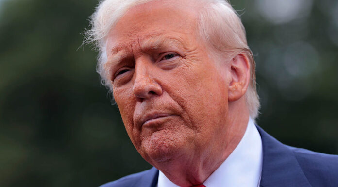 Donald Trump diagnosed with chronic venous insufficiency following leg swelling