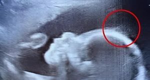Doctors couldn’t believe what they saw during the ultrasound