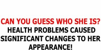 Can you recognize her? Health issues caused significant changes to her appearance