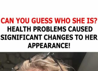 Can you recognize her? Health issues caused significant changes to her appearance
