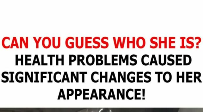 Can you recognize her? Health issues caused significant changes to her appearance