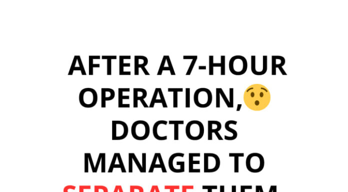 Conjoined twins separated after 7-hour surgery – This is them today