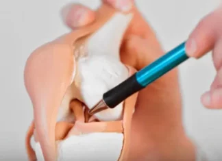 6 foods that silently drain calcium from the body, the more you eat, the weaker your bones become