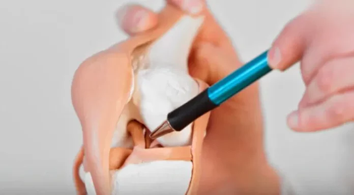 6 foods that silently drain calcium from the body, the more you eat, the weaker your bones become