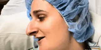Woman spends over a decade saving for a nose job—better sit down before seeing her after