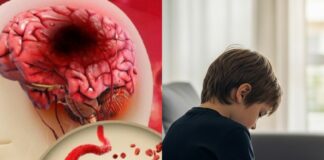 6-year-old boy has stroke after waking up – doctor warns parents to watch for 4 key signs