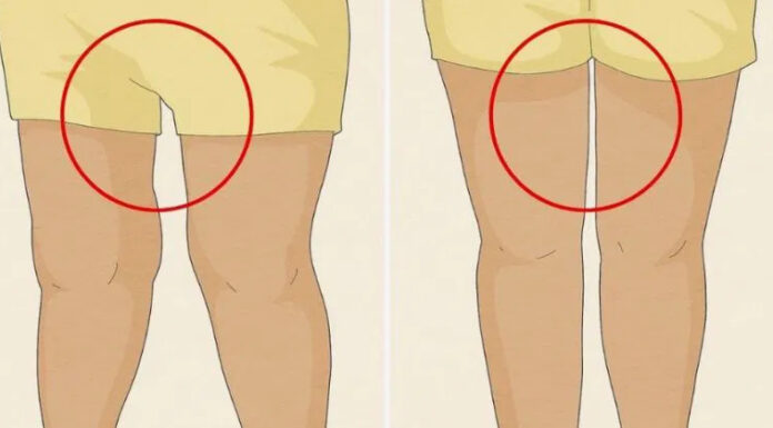 The gap between a woman’s legs can reveal that she is…
