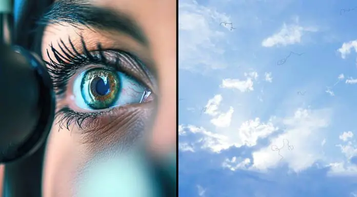 Eye floaters: what they are and what to do if you notice them, according to an eye doctor