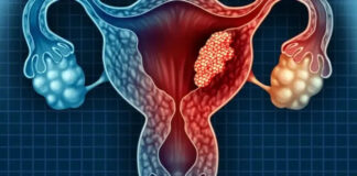 3 intimate habits of husbands that may increase wives’ risk of cervical cancer