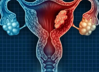 3 intimate habits of husbands that may increase wives’ risk of cervical cancer