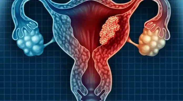 3 intimate habits of husbands that may increase wives’ risk of cervical cancer