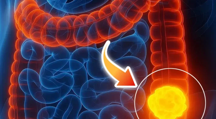 Woman reveals 5 colon cancer symptoms that shouldn’t be ignored