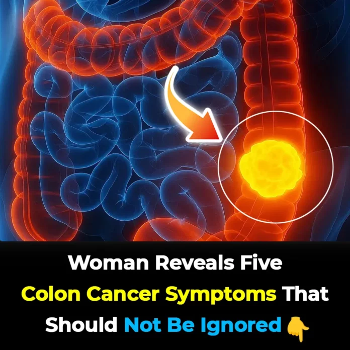 Woman reveals 5 colon cancer symptoms that shouldn’t be ignored