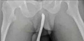 Teen Rushed to Hospital After Dangerous Experiment: A Stark Reminder on Safety