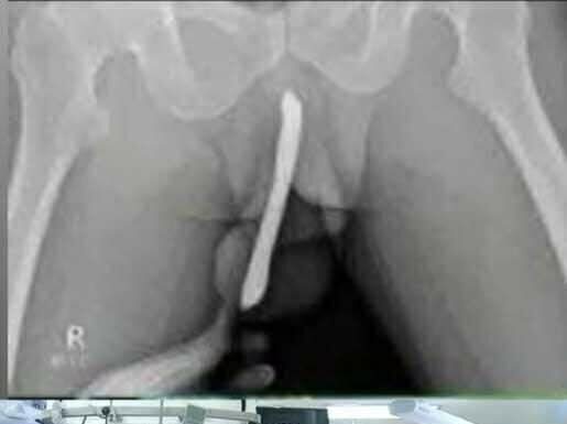 Teen Rushed to Hospital After Dangerous Experiment: A Stark Reminder on Safety